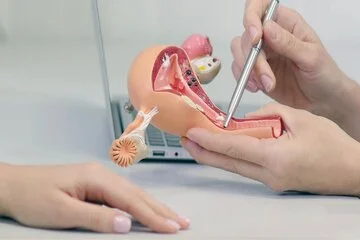 Gynecological laproscopy